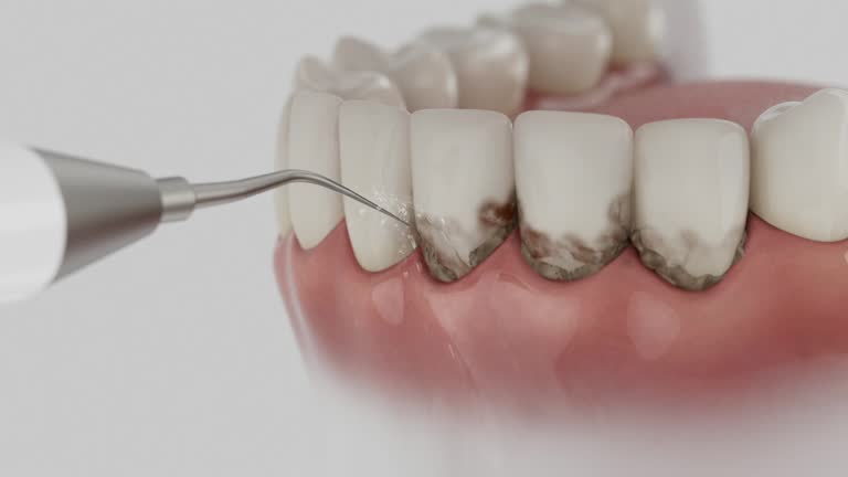 Reliable Dental contractor in Beverly, OH by Dentist Open Now